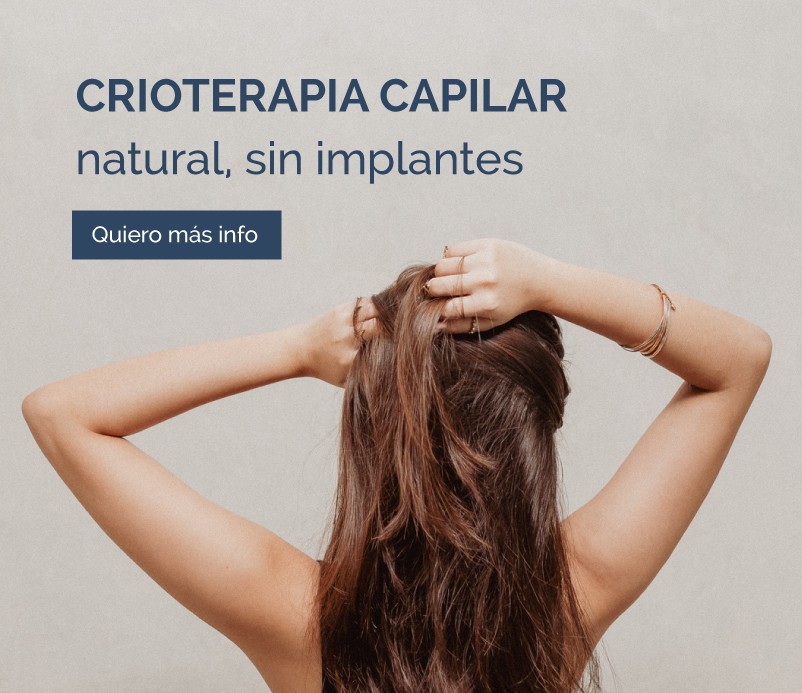 Crioterapia Capilar